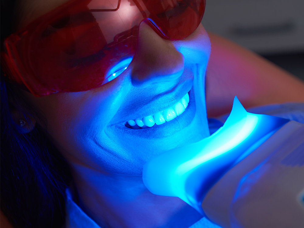 teeth-whitening-featured-image-royal-beauty-miami-34
