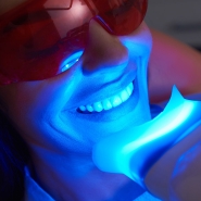 teeth-whitening-featured-image-royal-beauty-miami-34